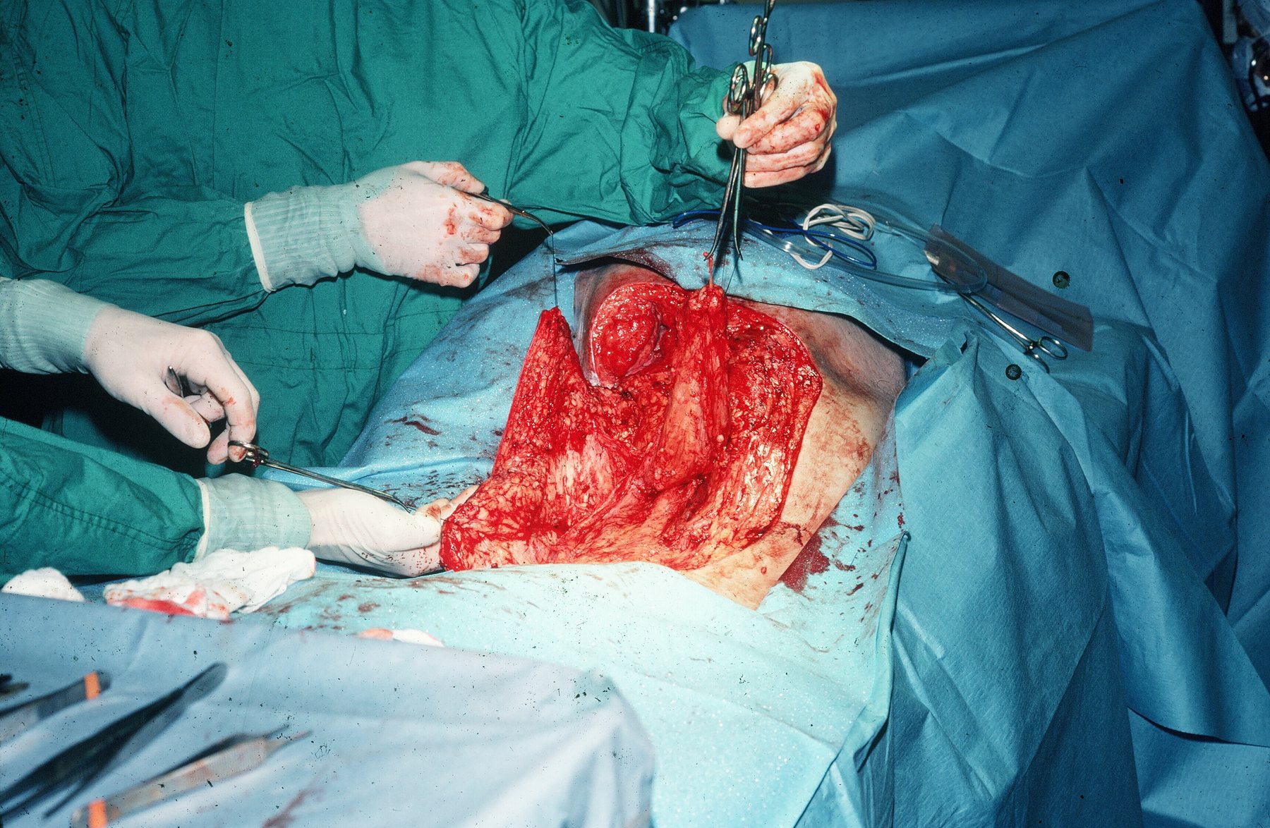 Surgical image preview