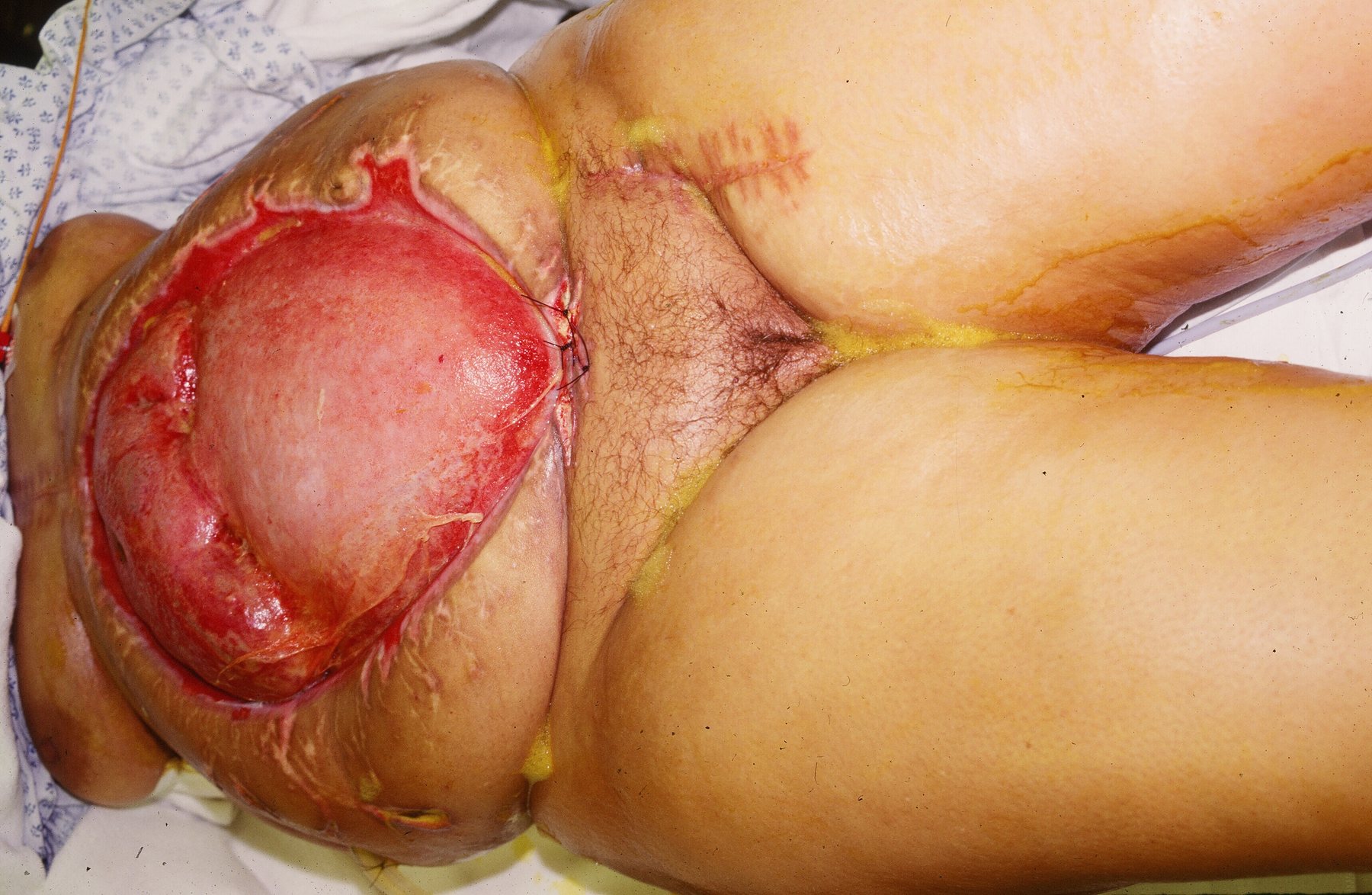 Surgical image preview