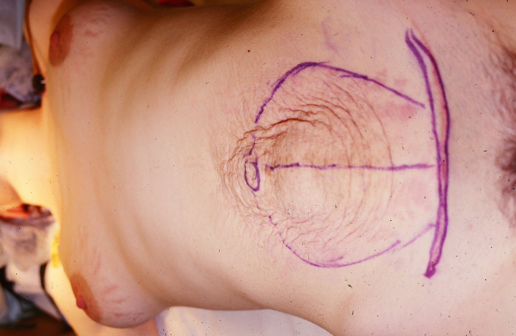 Surgical image preview