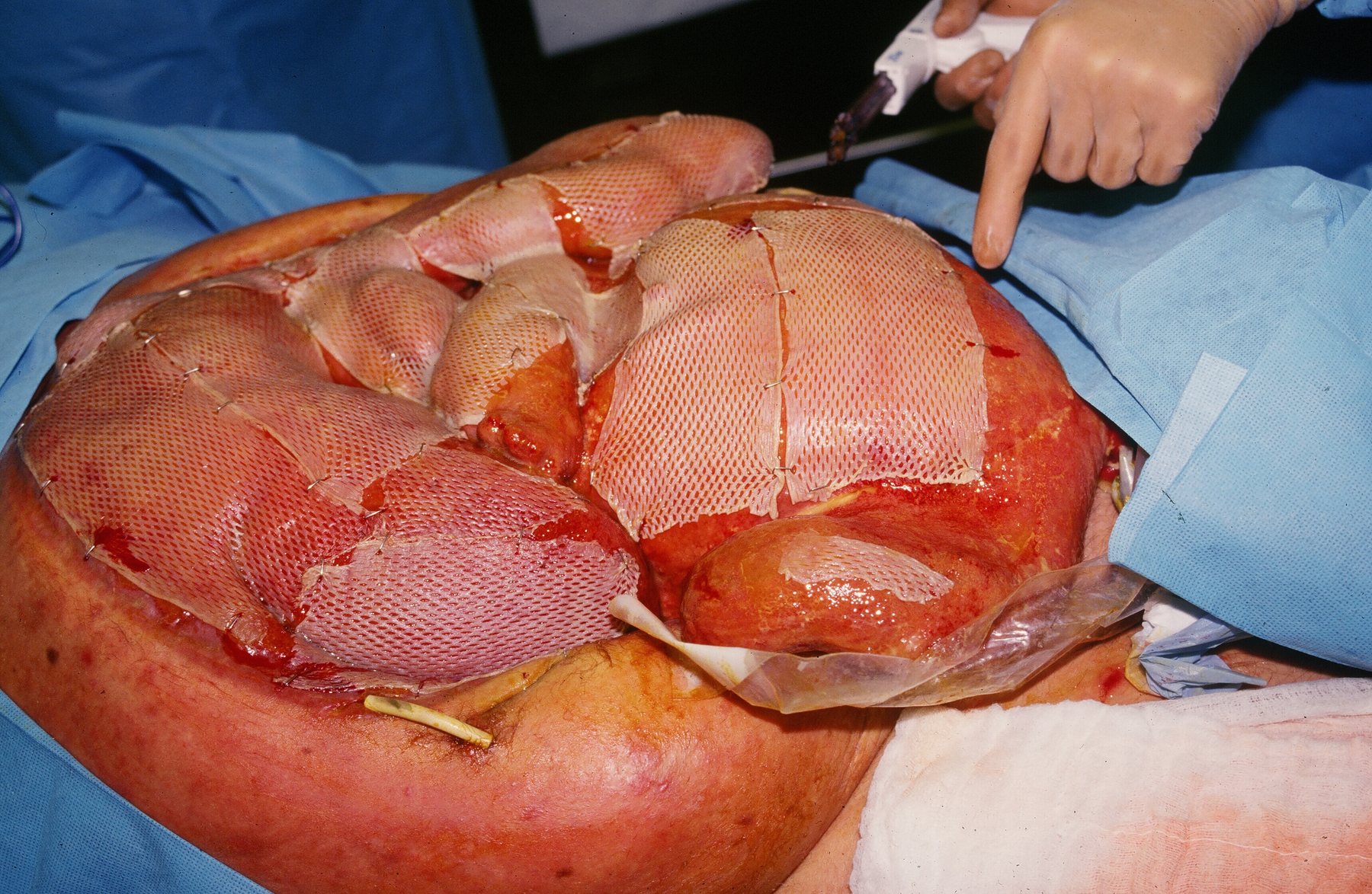 Surgical image preview